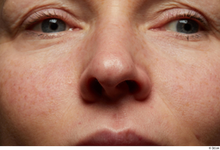 HD Face Skin Vivian Dennis face nose skin pores skin…